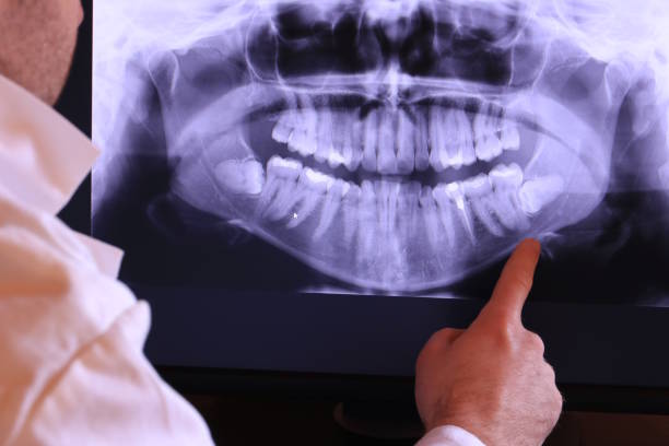 Best Emergency Gum Pain Relief  in Edgemoor, DE